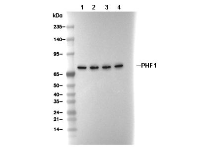 PHF1 Antibody [M20F24] WB