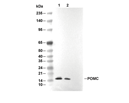 POMC Antibody [B13A5] WB