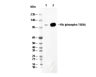 Phospho-Rb (Thr826) Antibody [F21F15] WB