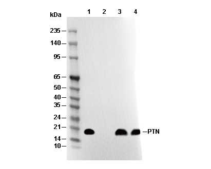 PTN Antibody [B1M21] WB