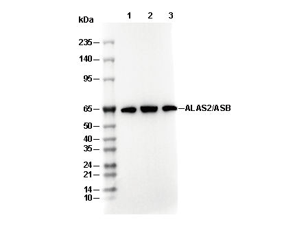 ALAS2/ASB C-terminal Antibody [D24K10] WB