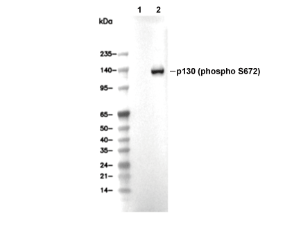 Phospho-p130 (Ser672) Antibody [E21C6] WB