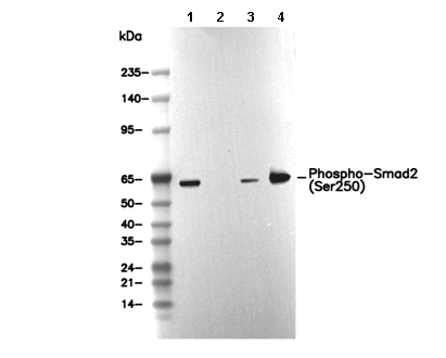 Phospho-Smad2 (Ser250) Antibody [J3P10] WB