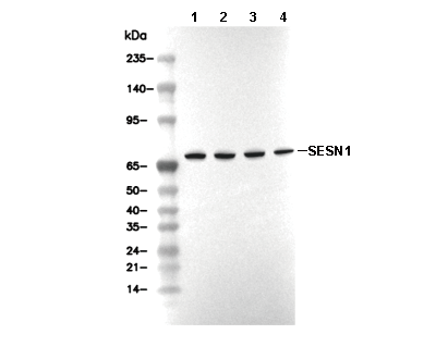 SESN1 Antibody [C3P2] WB