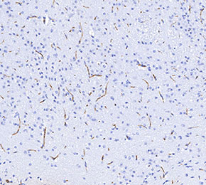 F3465-IHC1