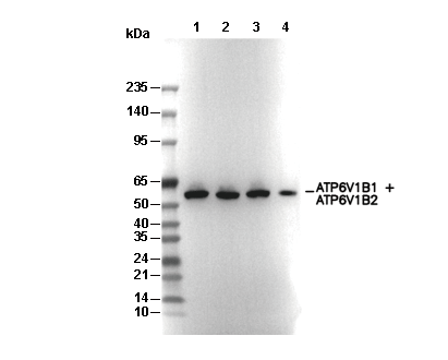 ATP6V1B1 + ATP6V1B2 Antibody [F8N24] WB