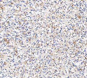 F3474-IHC1