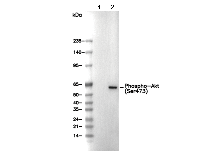 Phospho-Akt (Ser473) Antibody [B19D19] WB