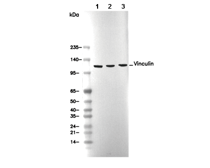 Vinculin Antibody [K4D1] WB