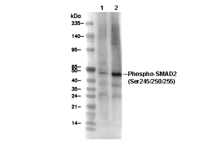 Phospho-SMAD2 (Ser245/250/255) Antibody [H4M3] WB