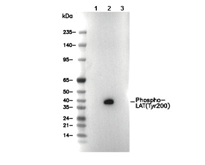 Phospho-LAT(Tyr200) Antibody [B1B14] WB