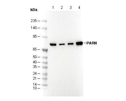 PARN Antibody [L9K20] WB