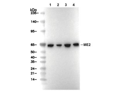 ME2 Antibody [B19K5] WB