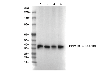PPP1CA + PPP1CB Antibody [D19B4] WB
