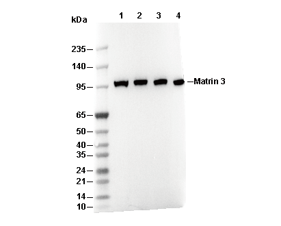 Integrin &beta; 3 Antibody [P12C15] WB