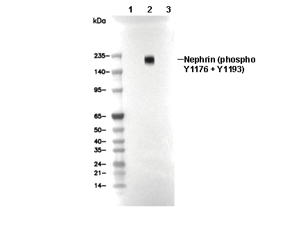 Phospho-Nephrin (Tyr1176 + Tyr1193) Antibody [D21M18] WB