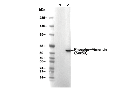 Phospho-Vimentin (Ser39) Antibody [B14E20] WB
