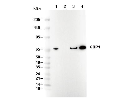 GBP1 Antibody [A8M6] WB