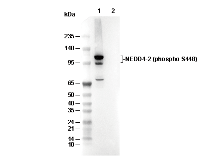 Phospho-NEDD4-2 (Ser448) Antibody [D21H23] WB