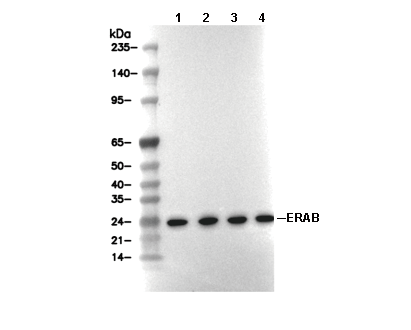ERAB Antibody [M20E24] WB