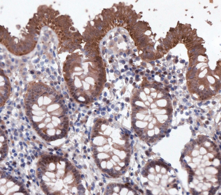 F3674-IHC1