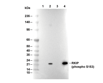 Phospho-RKIP (Ser153) Antibody [J22F24] WB