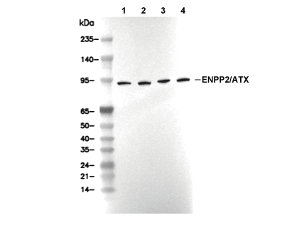 ENPP2/ATX Antibody [J20P19] WB