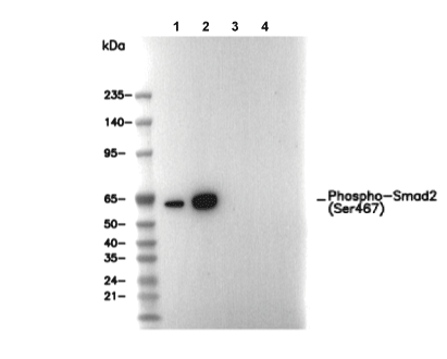 Phospho-Smad2 (Ser467) Antibody [P3A22] WB