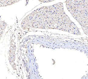 F3741-IHC1