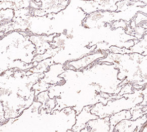 F3800-IHC1