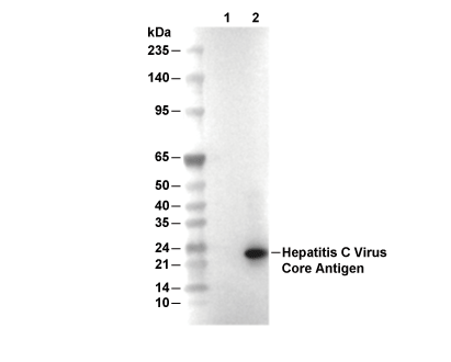 Hepatitis C Virus Core Antigen Antibody [N23M4] WB