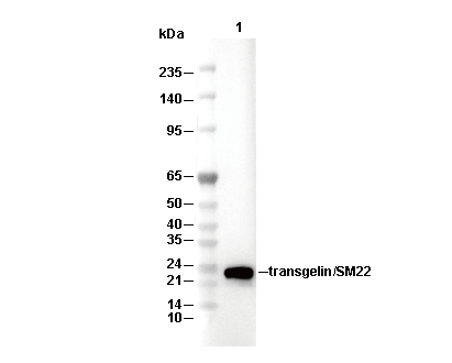 transgelin/SM22 Antibody [H9M7] WB