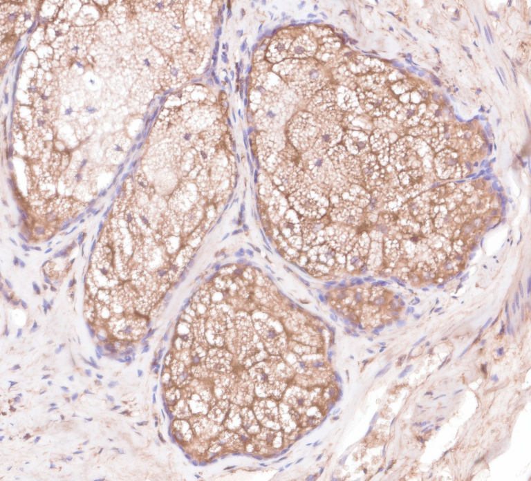 F3833-IHC1