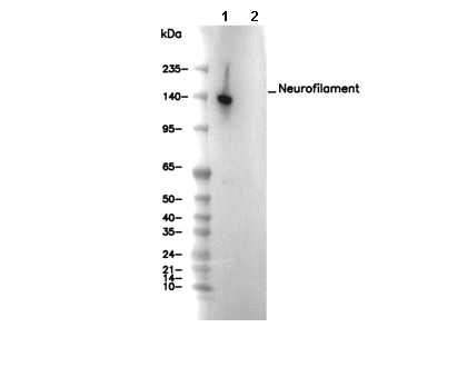 Neurofilament Antibody [E10M6] WB