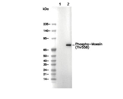Phospho-Moesin (Thr558) Antibody [N2L9] WB