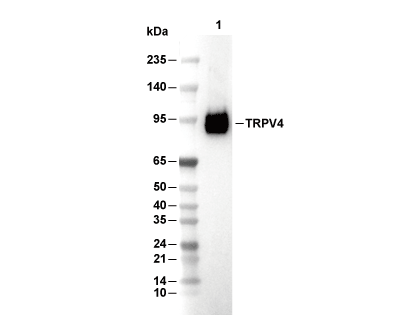TRPV4 Antibody [M19L9] WB