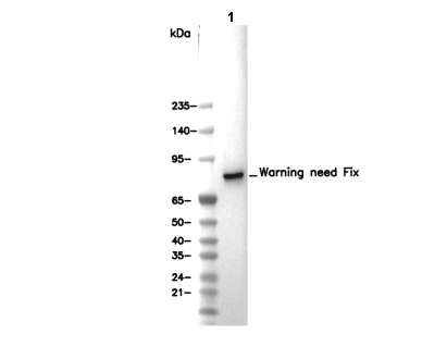 STIM1 Antibody [D10B10] WB