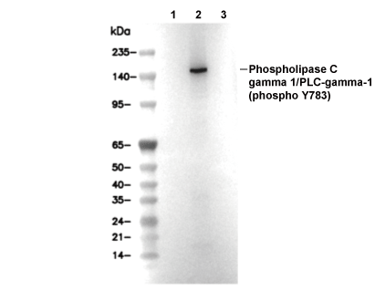 Phospho-Phospholipase C&gamma;1/PLC-&gamma;-1 (Tyr783) Antibody [J4J15] WB