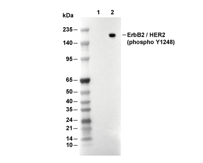 Phospho-ErbB2/HER2 (Tyr1248) Antibody [F22D17] WB