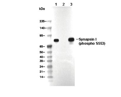 Phospho-Synapsin I (Ser553) Antibody [F18C24] WB