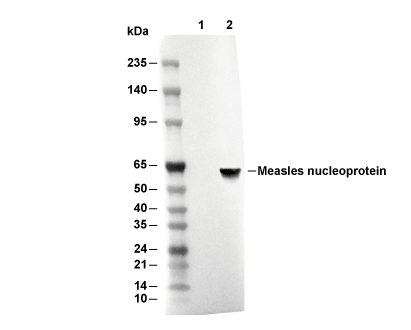 Measles nucleoprotein Antibody [H14C20] WB