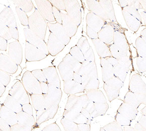 F3991-IHC1