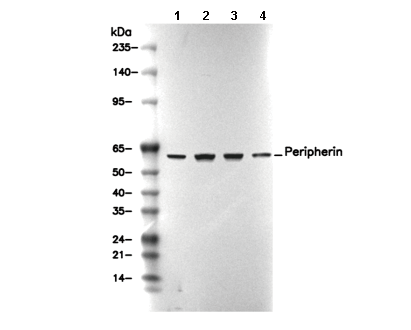 Peripherin Antibody [P7B12] WB