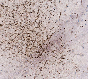 F4001-IHC1