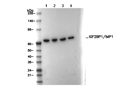 IGF2BP1/IMP1 Antibody [L17E6] WB