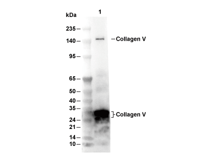 Collagen V Antibody [L8G6] WB