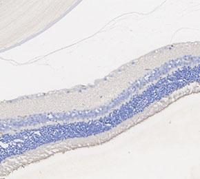 F4055-IHC1