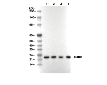 Rab9 Antibody [C1J10] WB