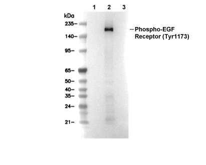 Phospho-EGF Receptor (Tyr1173) Antibody [E8J4] WB