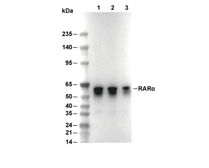 RAR&alpha; Antibody [M12K22] WB